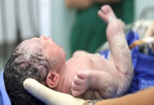 Caffeine therapy: Helpful for developing brains of Premature Babies