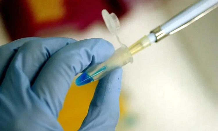 Scientists revealed they will apply HIV vaccine in humans