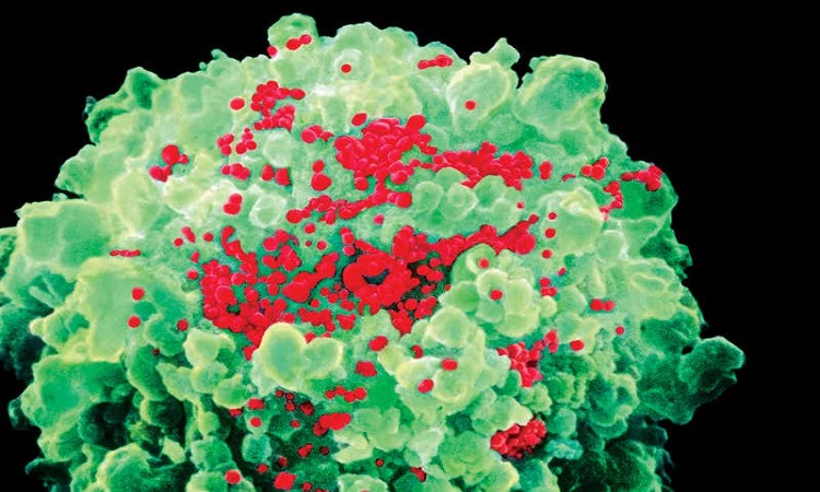 Spanish scientists created medicine that attacks cells that activate HIV
